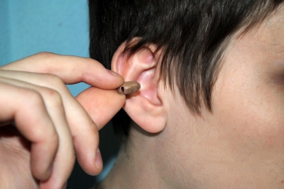 microauricular