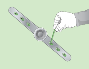 Mechanical cleaning - 2